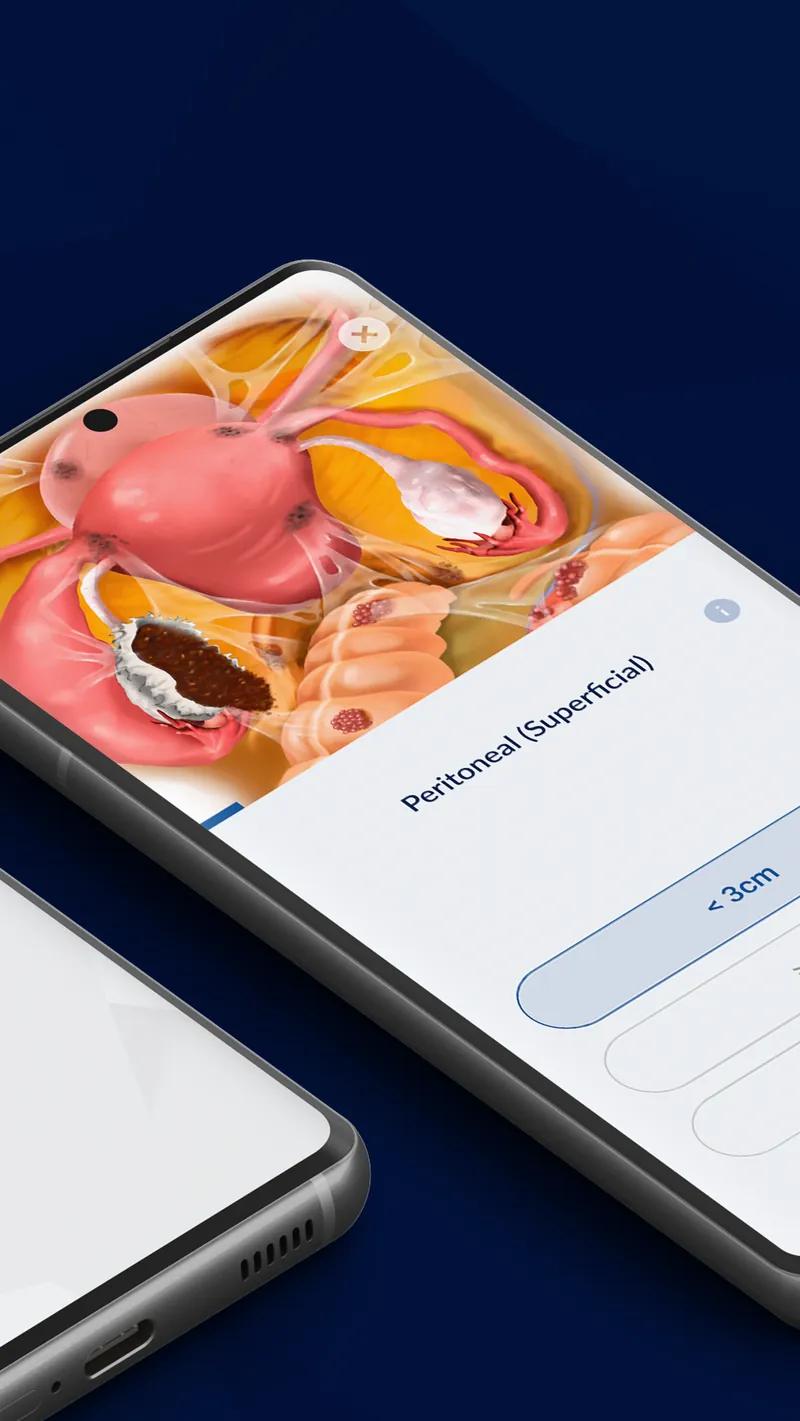 AAGL Endo Classification screenshot 3